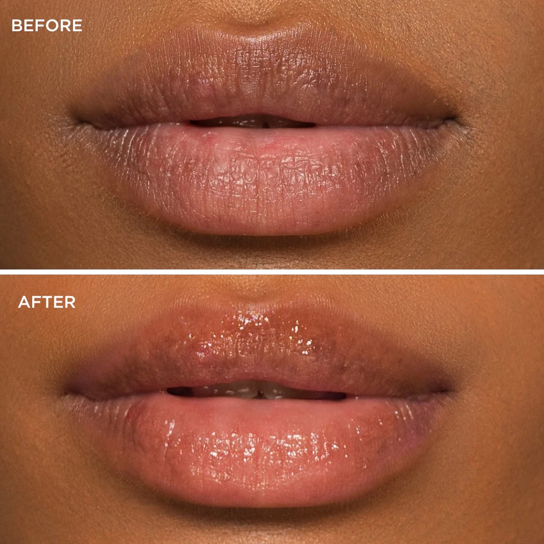 Original Clear Lip Balm - 10ml - Image 4