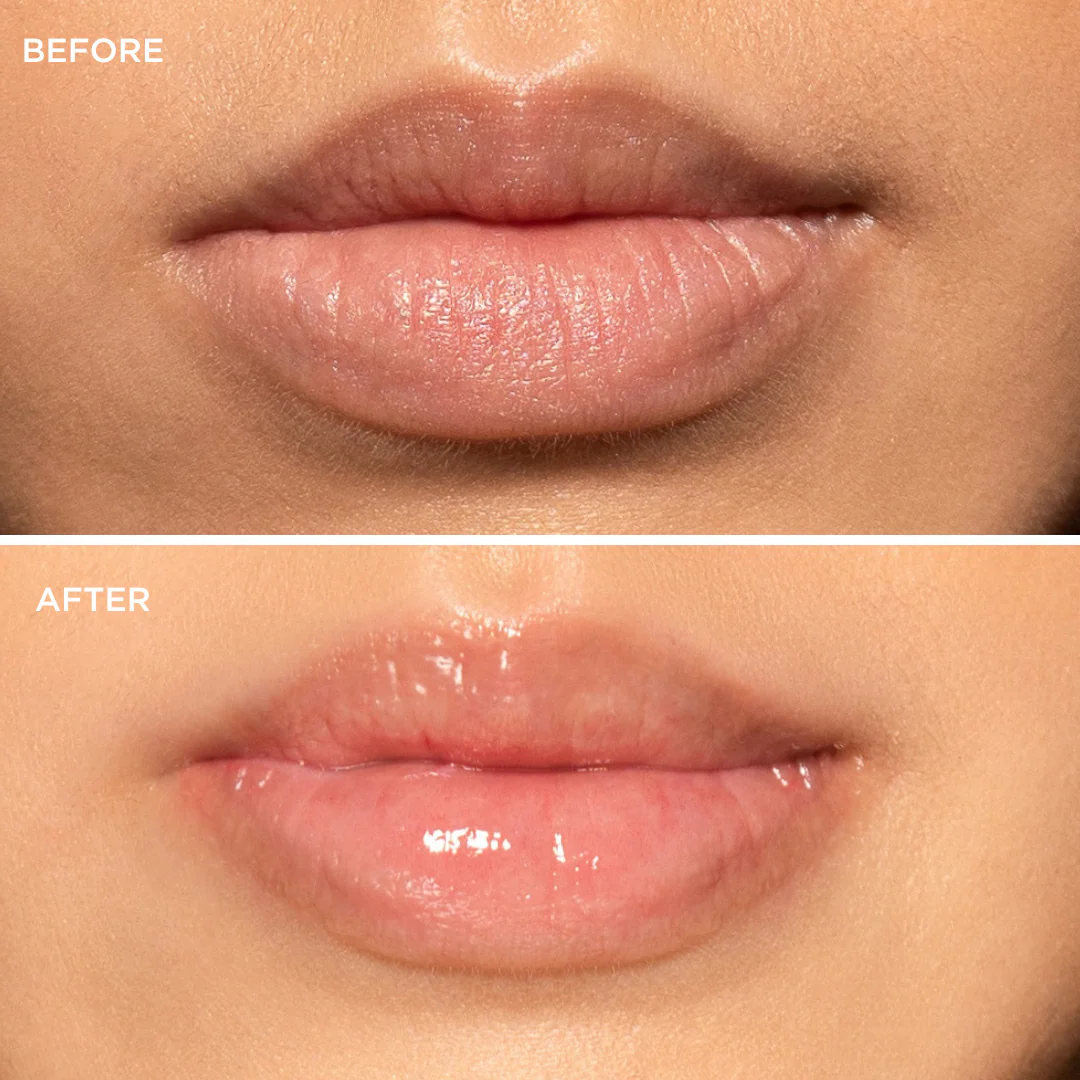 Original Clear Lip Balm - 10ml - Image 6